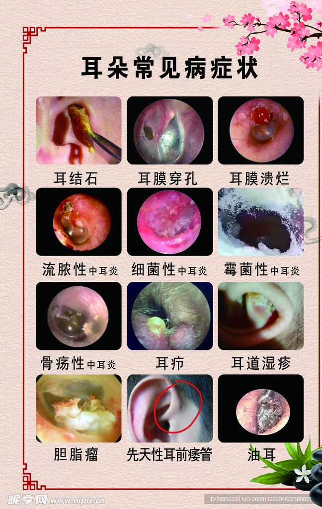 耳朵常见疾病