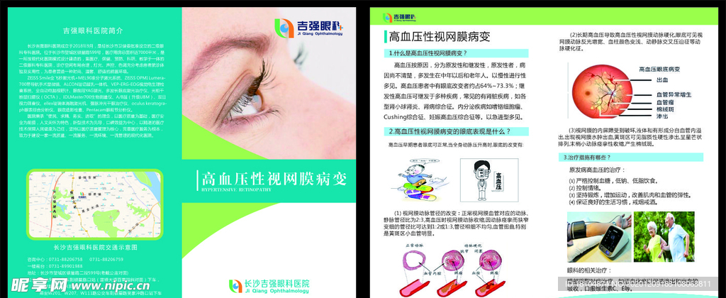 高血压性视网膜病变