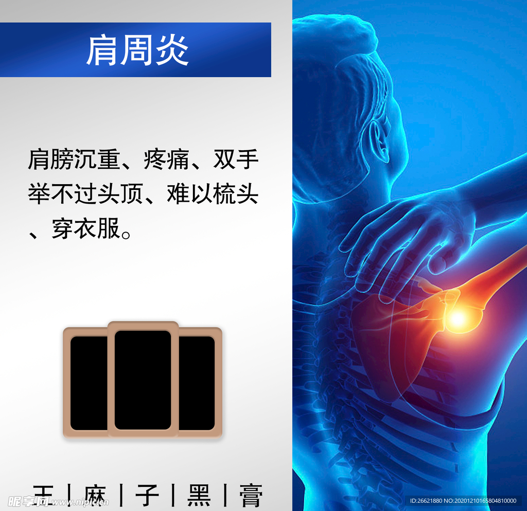 肩周炎