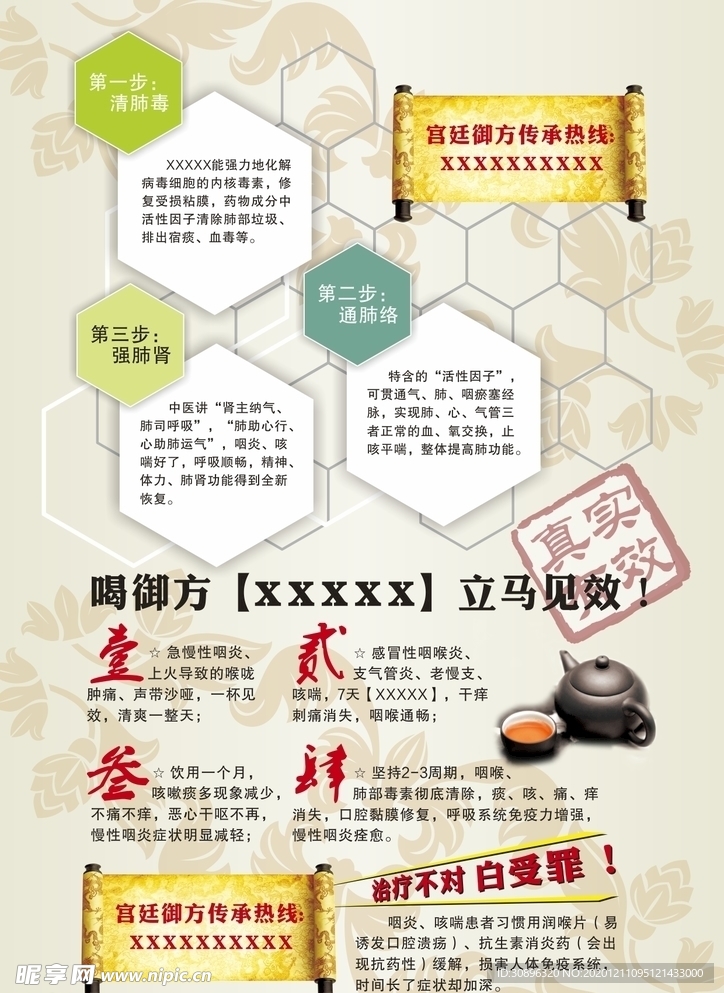 咽炎