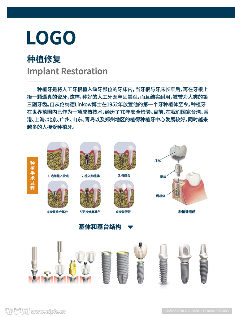 口腔知识种植修复步骤展板海报图