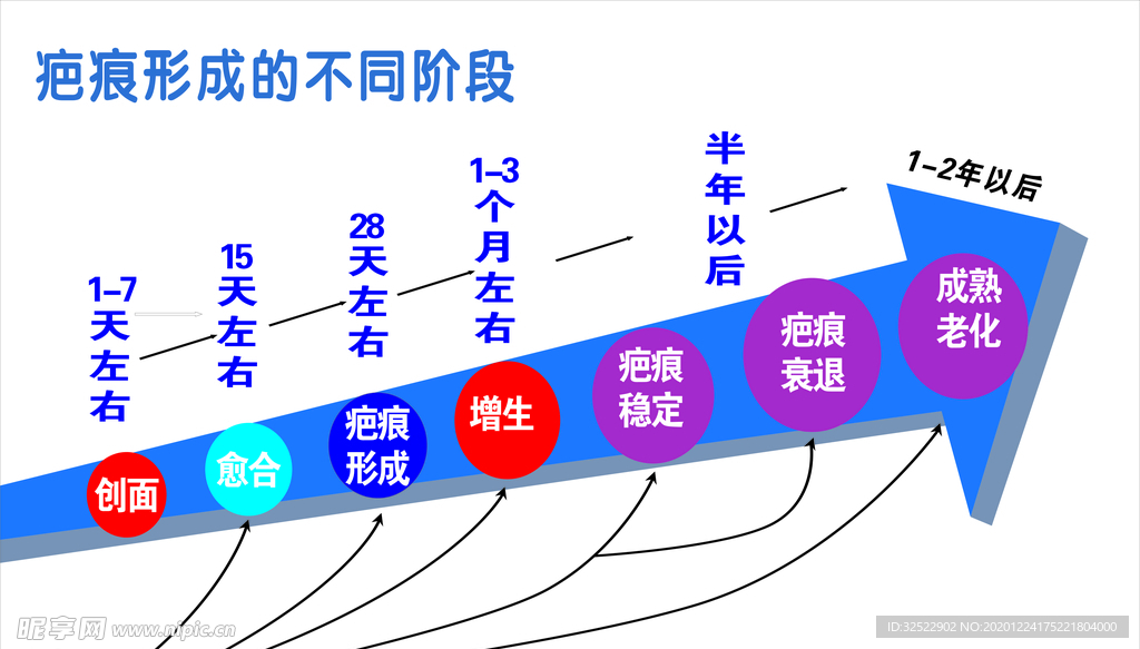 疤痕形成的不同阶段