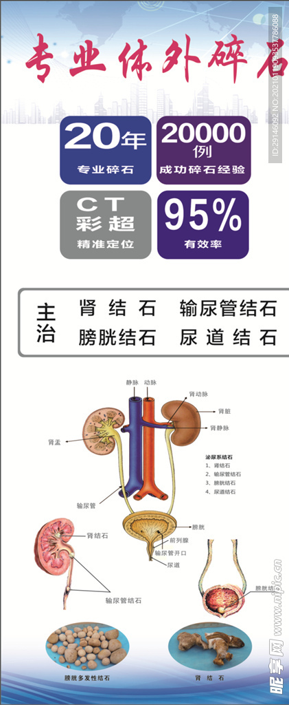 碎石展架