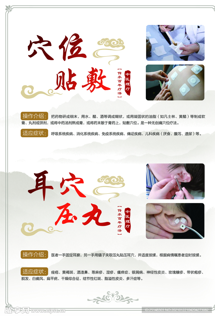 穴位贴敷耳穴压丸