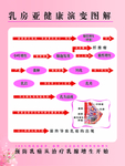 乳房亚健康演变图解海报