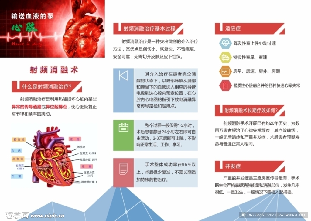 射频消融术