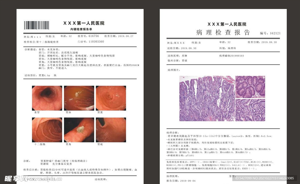 病理报告