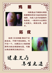 修脚  鸡眼 跖疣 足疗 养生