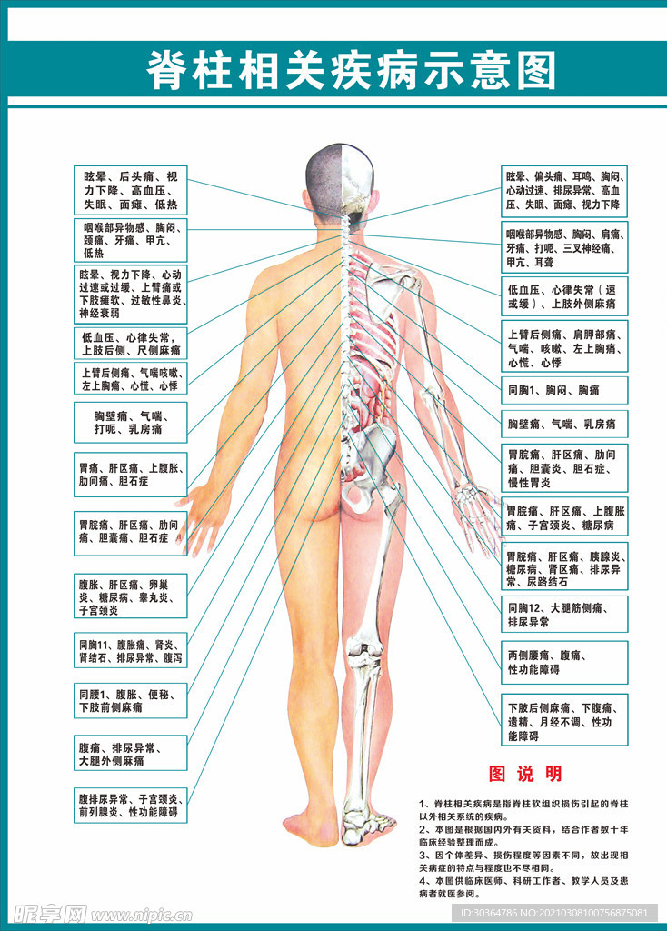 脊柱相关疾病示意图