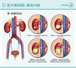 医疗肾解剖图