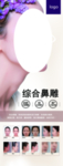 整形