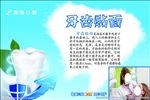牙贴面
