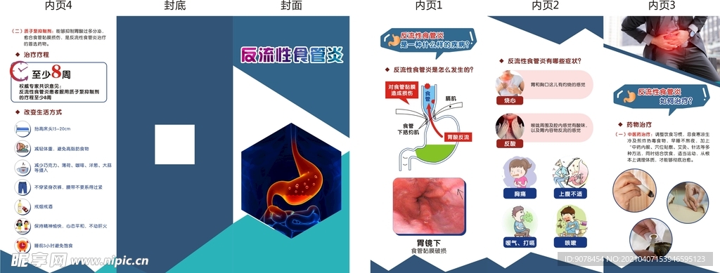 反流性食管炎折页