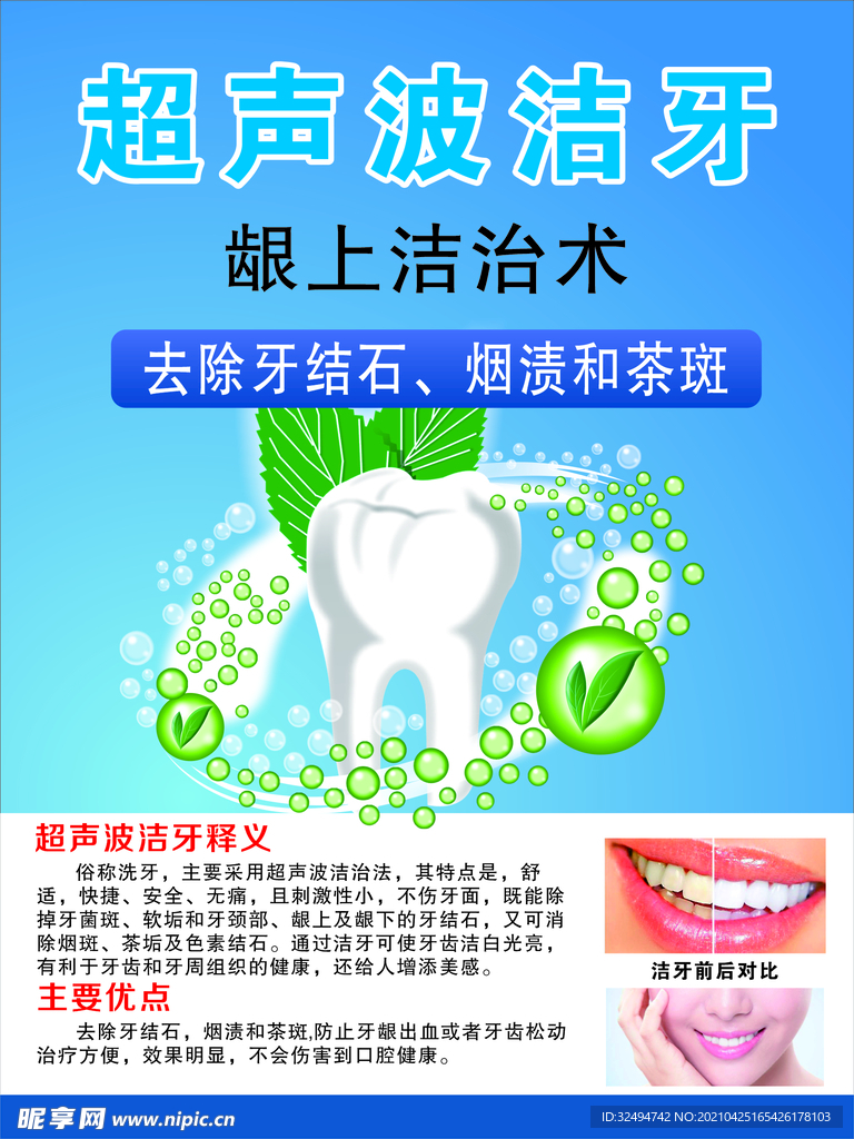 超声波洁牙