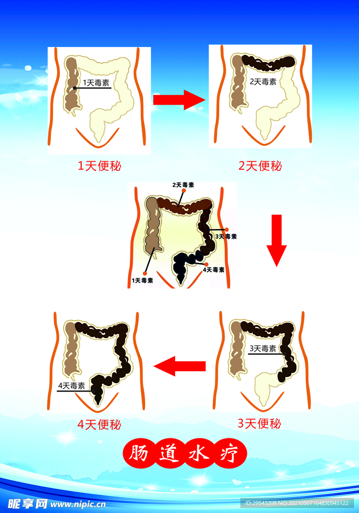 肠道水疗