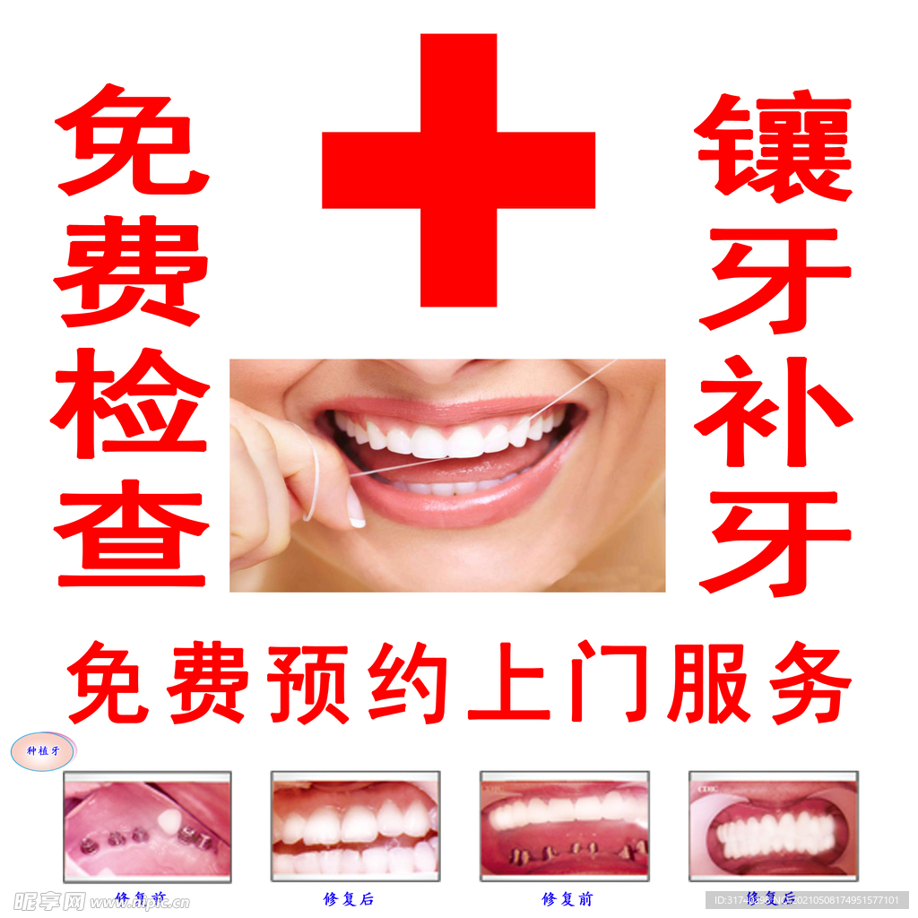 免费检查 补牙 镶牙