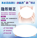 隐形牙齿矫正