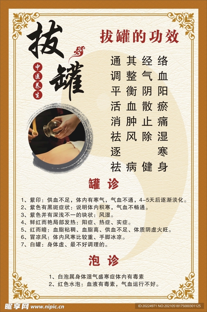 中医养生拔罐