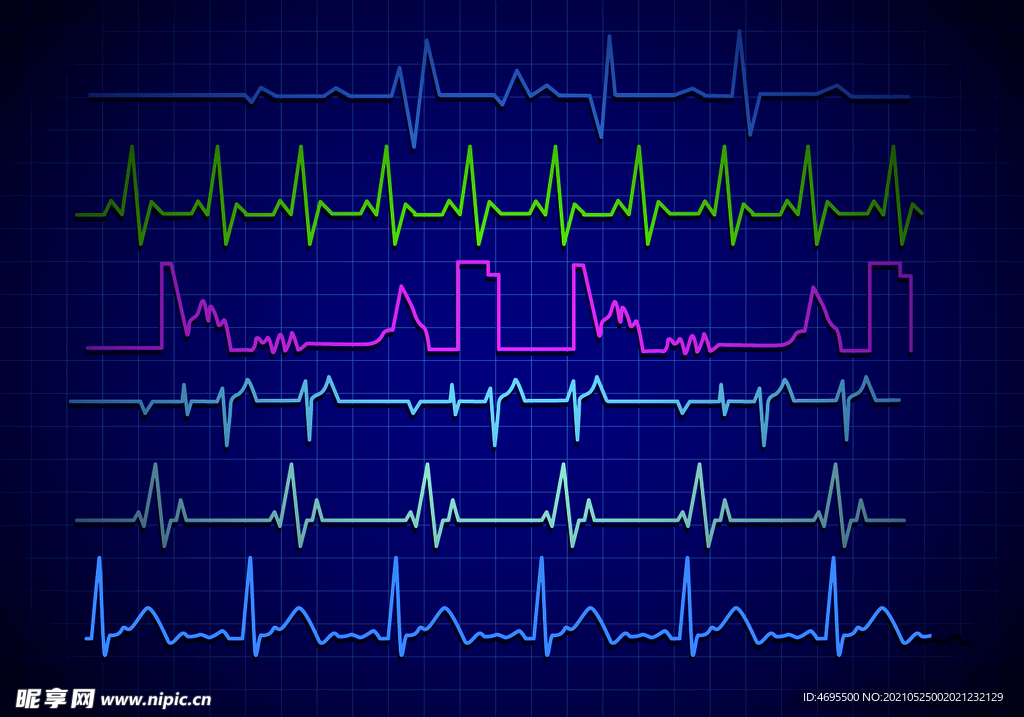 心电图矢量图