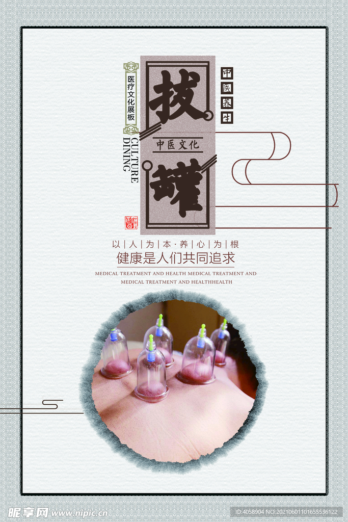 拔罐