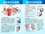 常见的妇科疾病