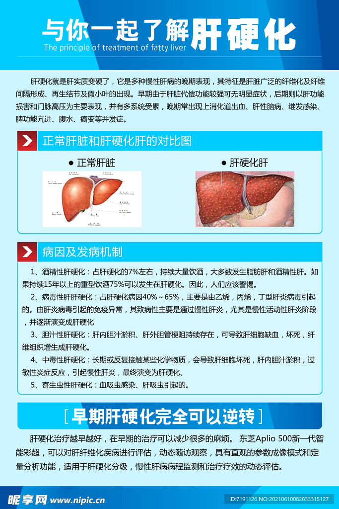 与你一起了解肝硬化