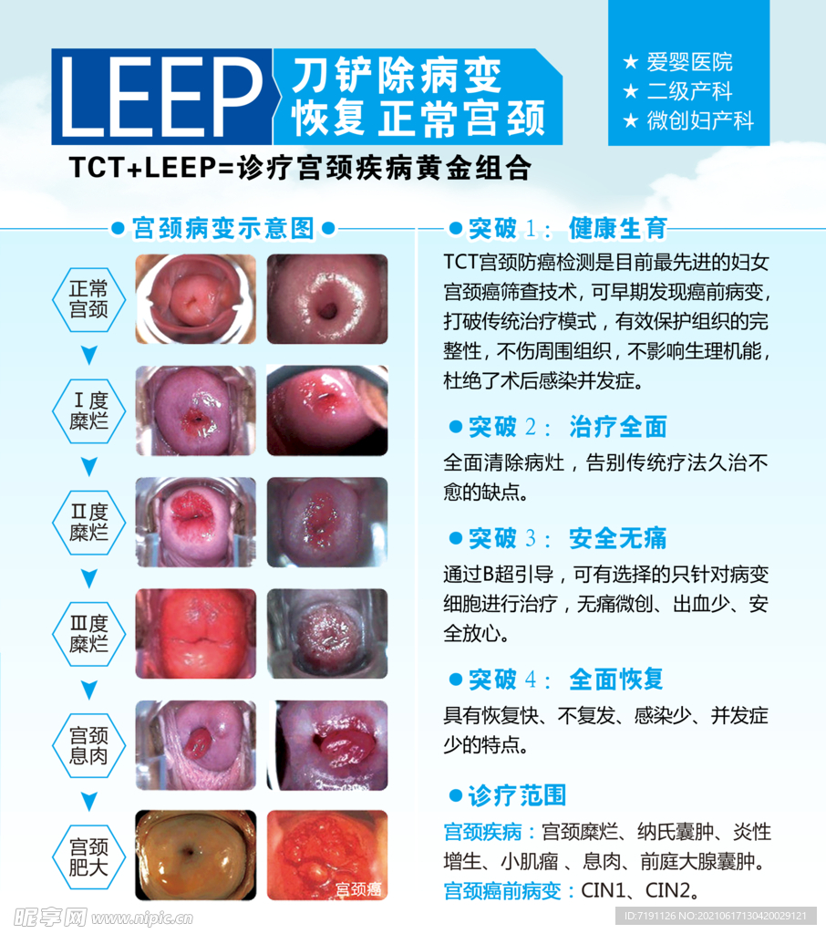 TCT和利普刀LEEP技术宣传