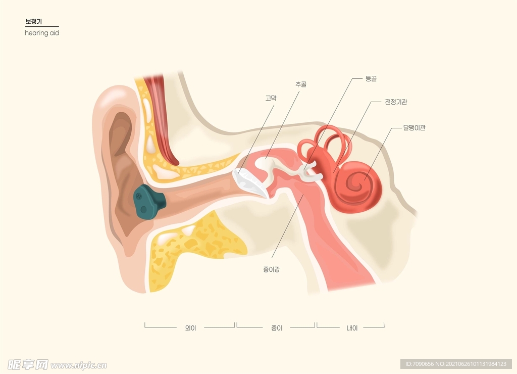 耳部助听器 
