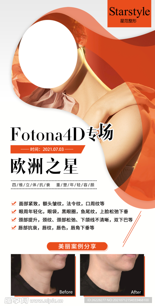 fotona 4D海报