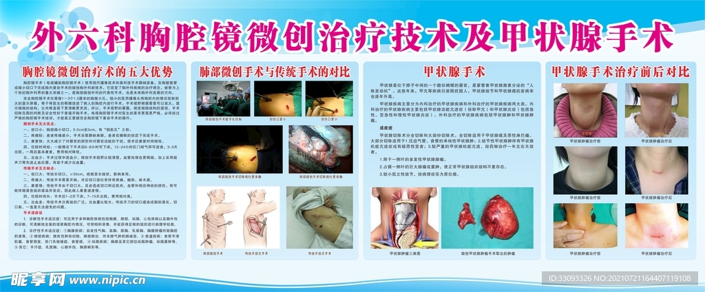 胸腔镜微创治疗技术及甲状腺手术