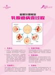 乳腺癌公益宣传海报