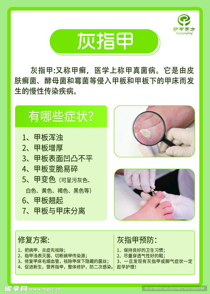 灰指甲