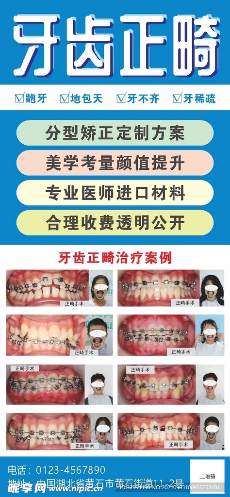 牙齿正畸