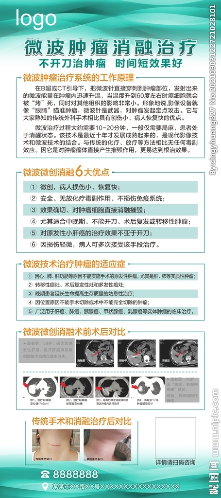 肿瘤消融