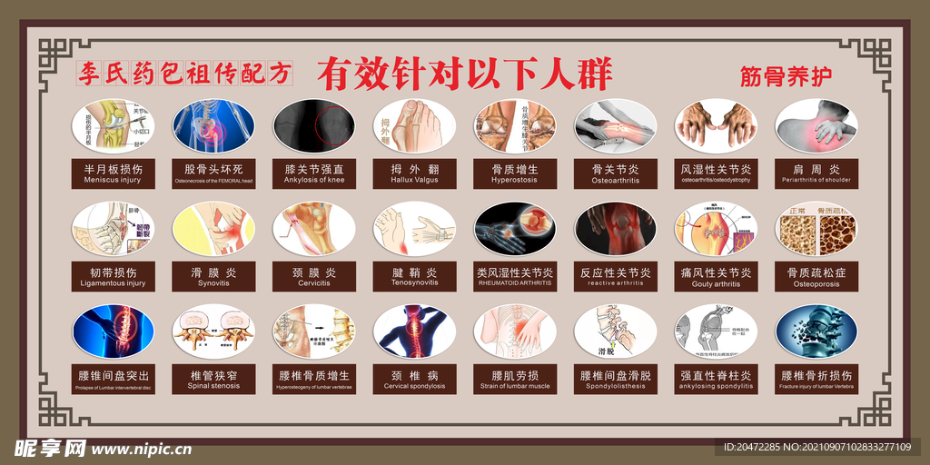 腰椎间盘
