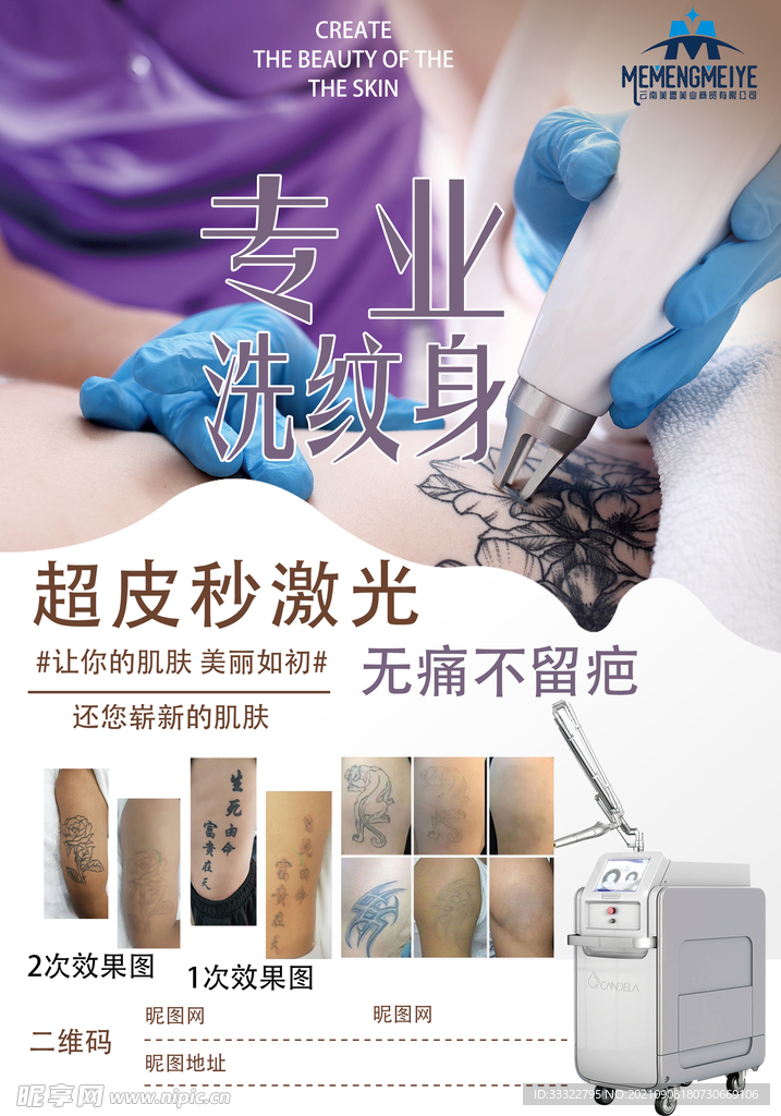 专业洗纹身