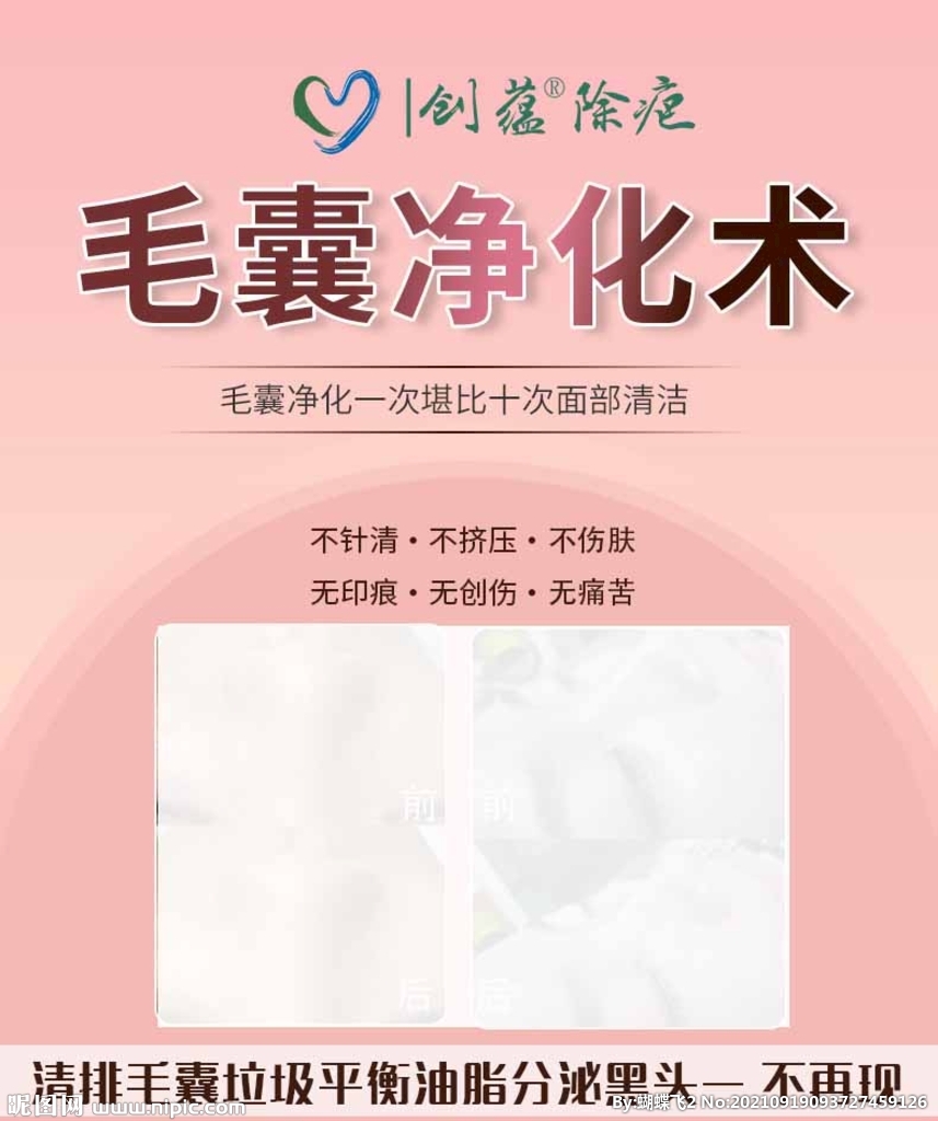 创蕴除疤