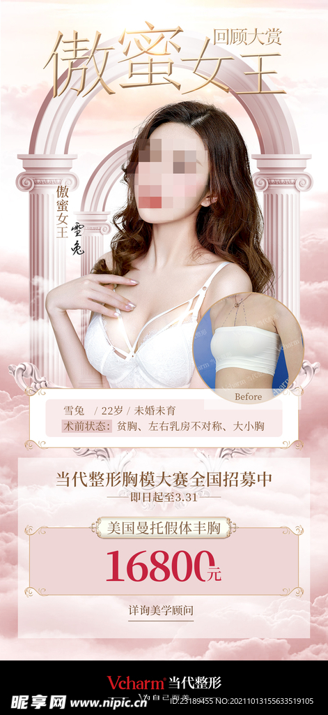 隆胸海报