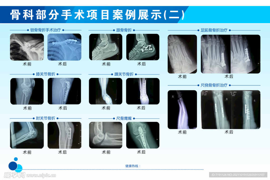 骨科部分手术项目案例展示