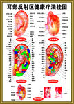耳部反射区健康疗法挂图