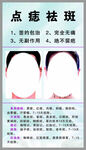 点痣
