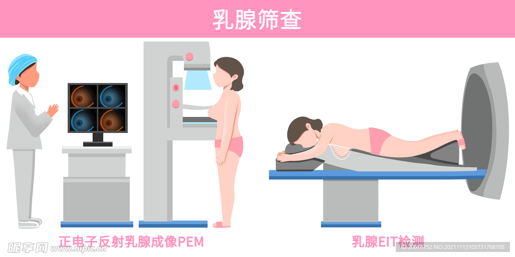 乳腺筛查