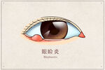 眼睑炎