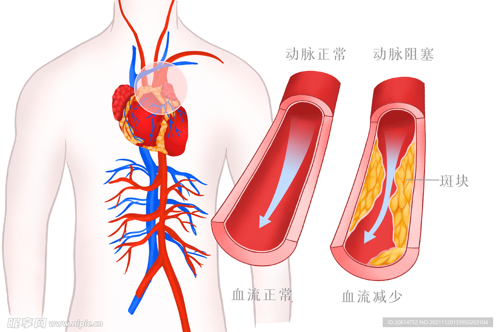 血管