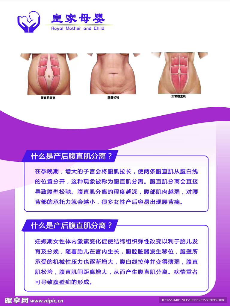 产后修复海报  腹直肌分离