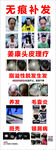 无痕补发