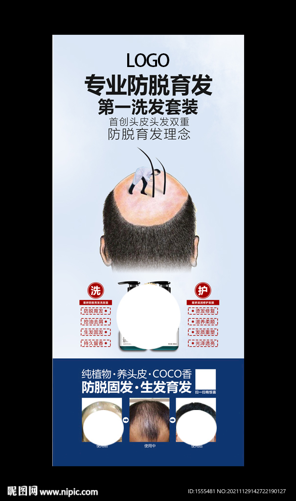防脱育发展架