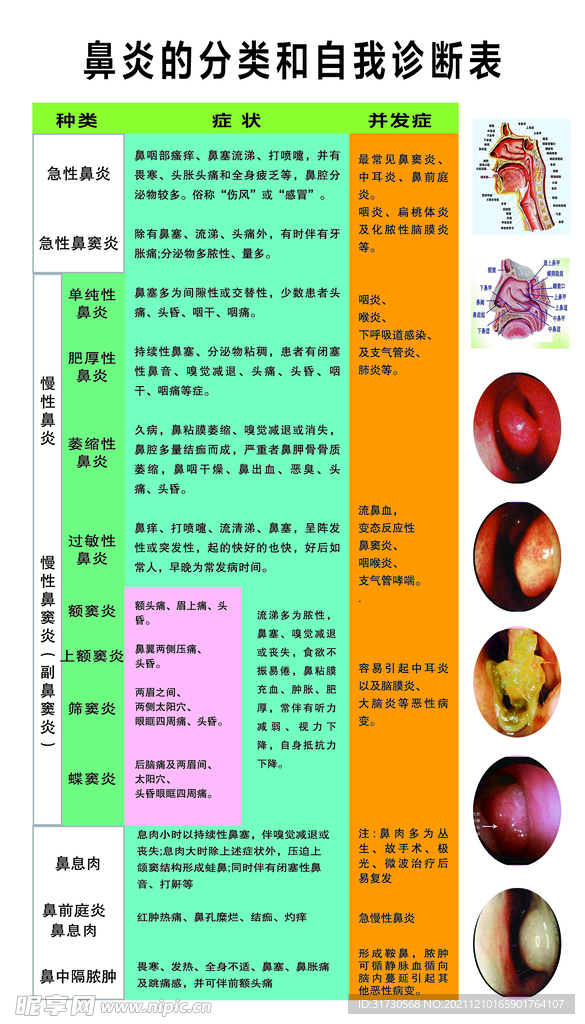 鼻炎分类