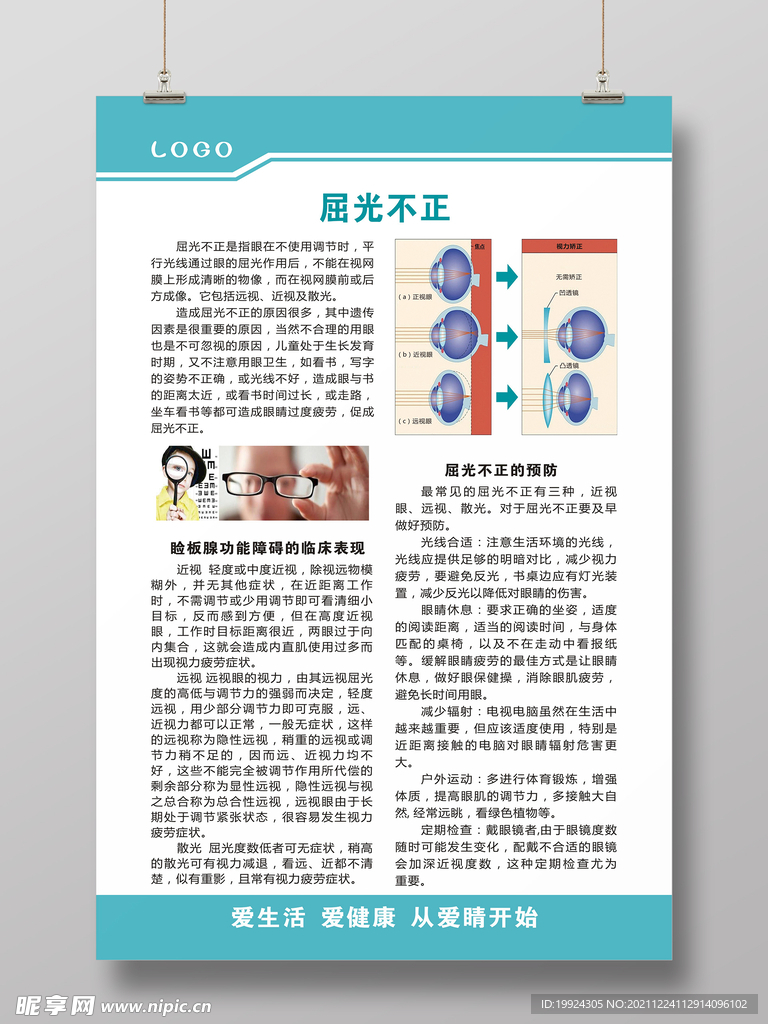 屈光不正