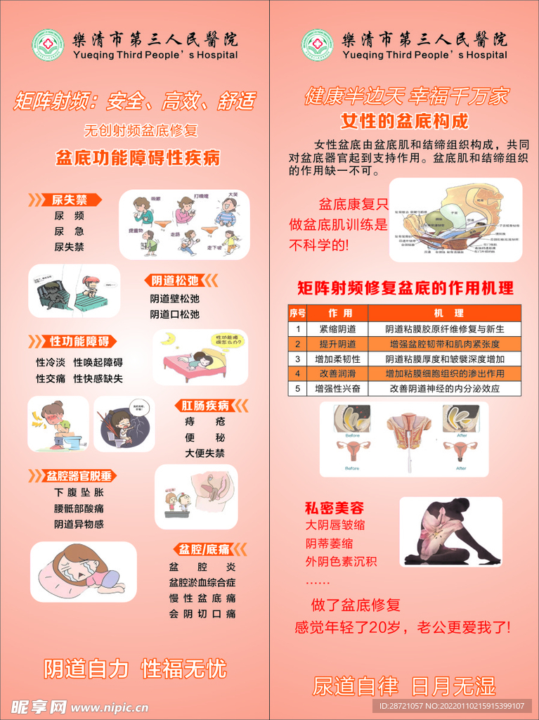 盆底展架